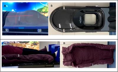 Comparison between supine and prone patient setup for lumbosacral spinal stereotactic body radiosurgery with CyberKnife